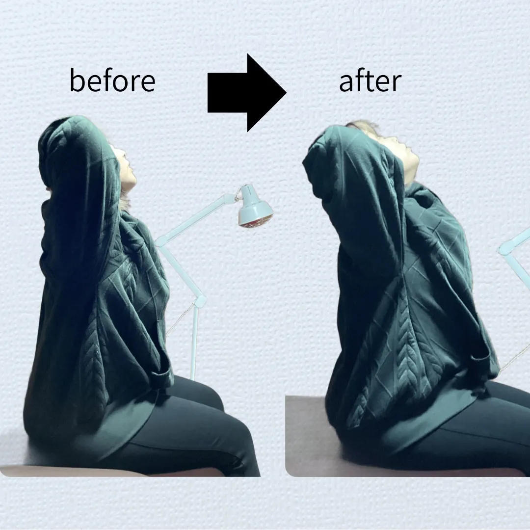 【肩こり/姿勢不良でお悩みの方へ】