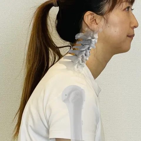 【ストレートネック】