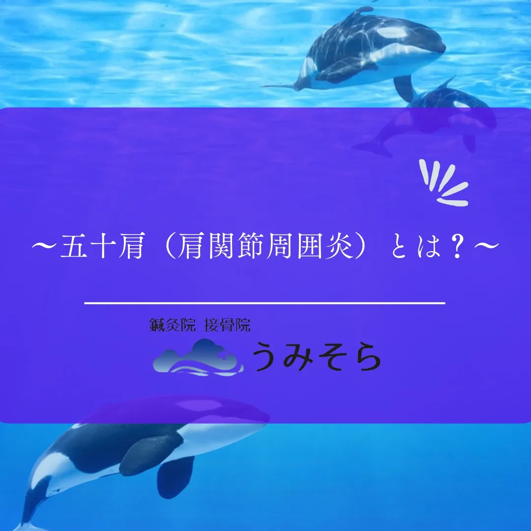 【五十肩(肩関節周囲炎)とは?】