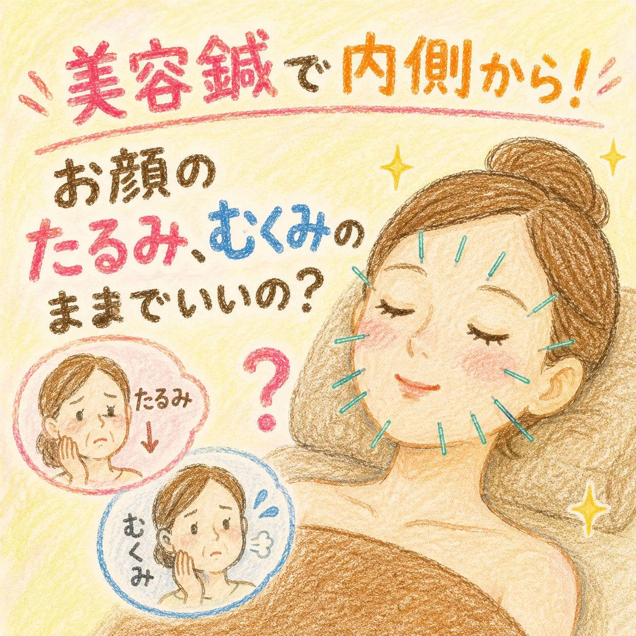 【砂田橋駅　美容鍼】