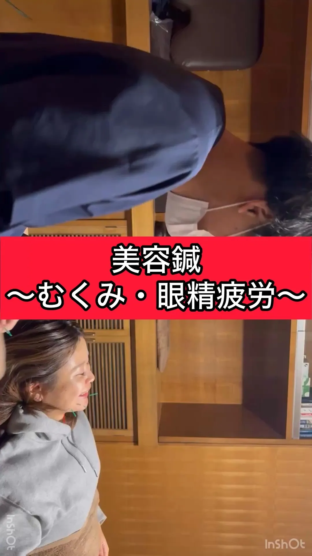 【美容鍼～むくみ・眼精疲労～】